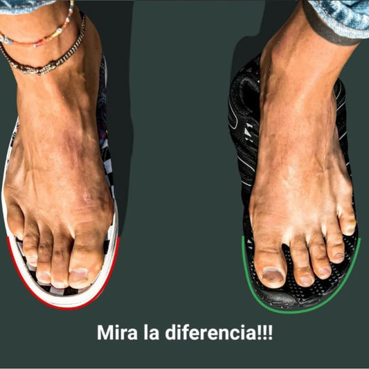 Zapatos para Juanetes: Cómo el Barefoot Reduce el Hallux Valgus